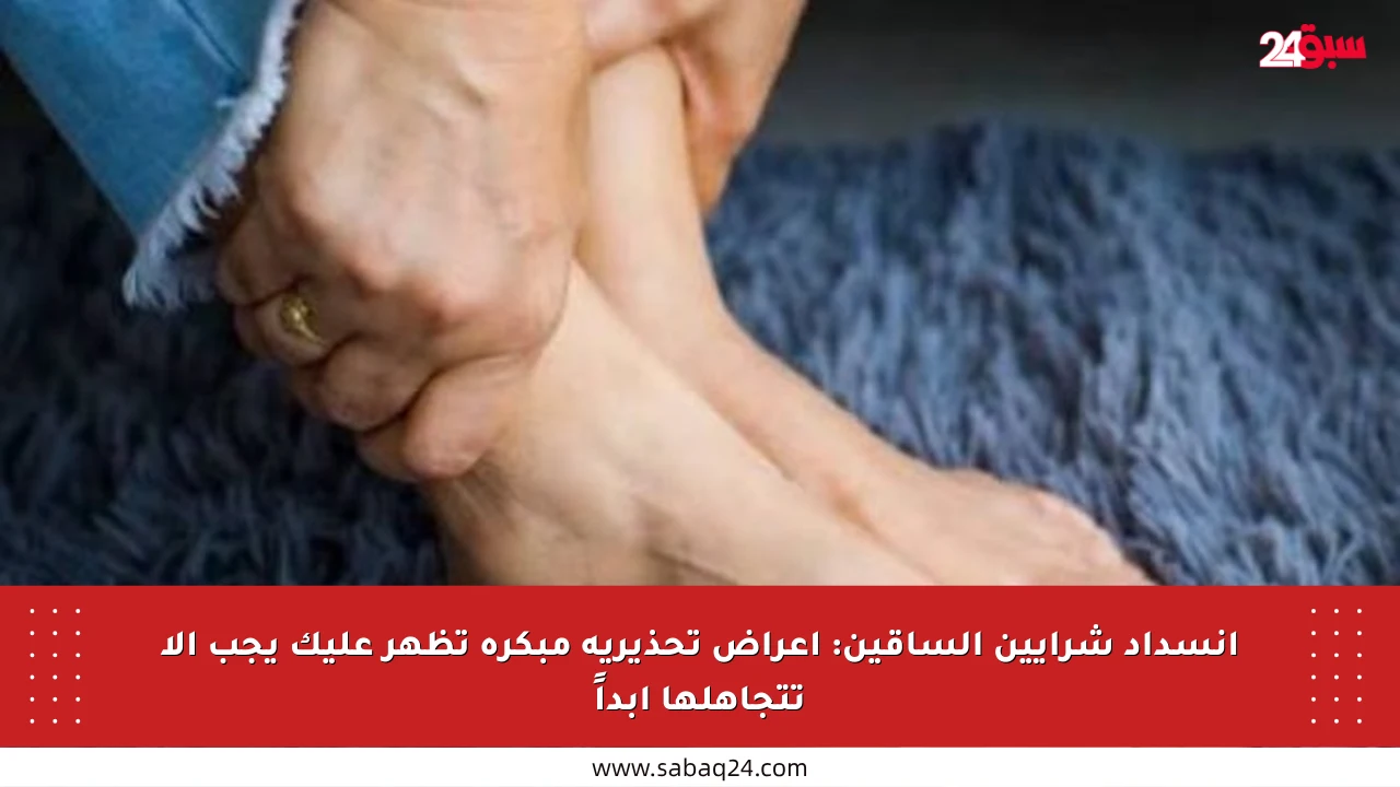 انسداد شرايين الساقين: أعراض تحذيرية مبكرة تظهر عليك يجب ألا تتجاهلها أبداً
